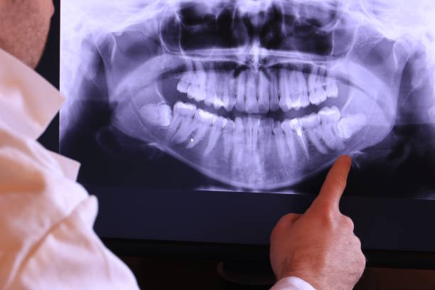 Best Emergency Root Canal Treatment in Cumberland, IN